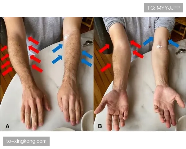 大腿肌肉拉伤至少需要一周恢复 萨林杰可能错过大部分常规赛